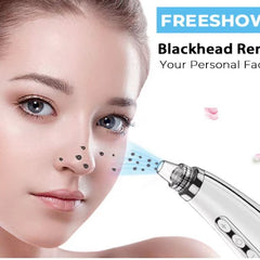 ZOLAA PorePure Variable-Frequency Blackhead Vacuum Remover