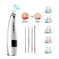 ZOLAA PorePure Variable-Frequency Blackhead Vacuum Remover