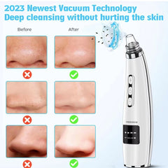 ZOLAA PorePure Variable-Frequency Blackhead Vacuum Remover