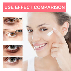 ZOLAA EELHOE Retinol Renewal Eye Cream Stick (Targeted Anti-Aging & Under-Eye Hydration)